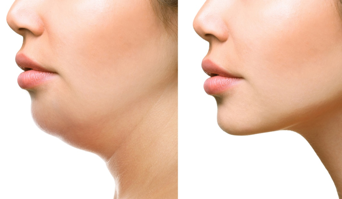 Exercises to Get Rid of Double Chin